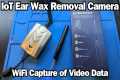IoT Ear Wax Removal Camera - WiFi