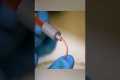 Gallium needle that doesn’t hurt