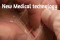 New Medical Technology