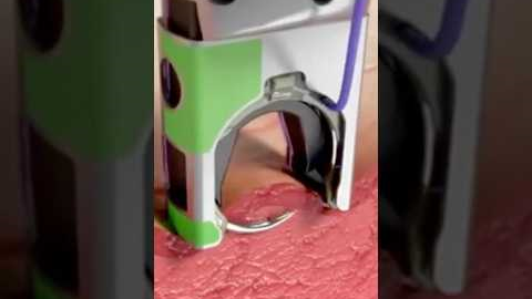 Automatic Surgical Stitch Devices! 😷 #goodtoknow #funfacts #vet #medicine #technology #suturing