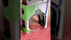 Automatic Surgical Stitch Devices! 😷 #goodtoknow #funfacts #vet #medicine #technology #suturing